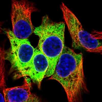 Immunocytochemistry/ Immunofluorescence: Carboxylesterase 1/CES1 Antibody [NBP2-48854]