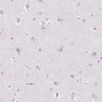 Immunohistochemistry-Paraffin: Carboxylesterase 1/CES1 Antibody [NBP1-85691]