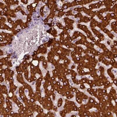 Immunohistochemistry-Paraffin: Carboxylesterase 1/CES1 Antibody [NBP2-48854]