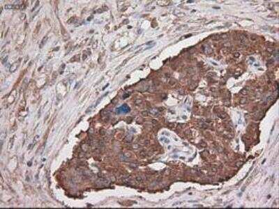 Immunohistochemistry-Paraffin: Carboxypeptidase A1/CPA1 Antibody (OTI2A3) [NBP1-47704]