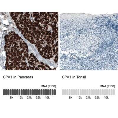 Immunohistochemistry-Paraffin: Carboxypeptidase A1/CPA1 Antibody (CL6629) [NBP2-76509]