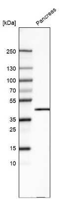 Western Blot: Carboxypeptidase A1/CPA1 Antibody (CL6629) [NBP2-76509]