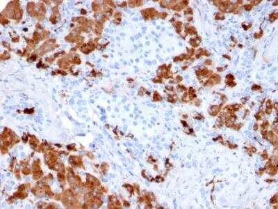Immunohistochemistry-Paraffin: Carboxypeptidase A1/CPA1 Antibody (CPA1/2712) - Azide and BSA Free [NBP2-79880]