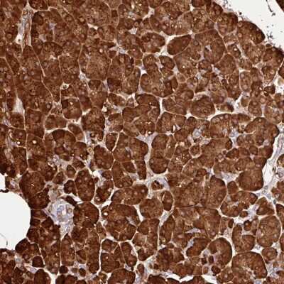 Immunohistochemistry-Paraffin: Carboxypeptidase A1/CPA1 Antibody [NBP2-33640]