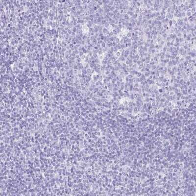 Immunohistochemistry-Paraffin: Carboxypeptidase A1/CPA1 Antibody [NBP2-33640]