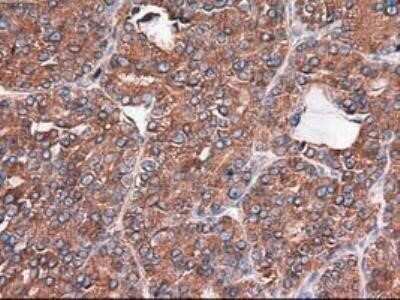 Immunohistochemistry: Carboxypeptidase A1/CPA1 Antibody (OTI2A3) - Azide and BSA Free [NBP2-70431]