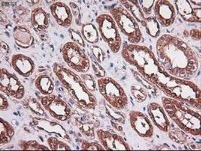 Immunohistochemistry: Carboxypeptidase A1/CPA1 Antibody (OTI2A3) - Azide and BSA Free [NBP2-70431]