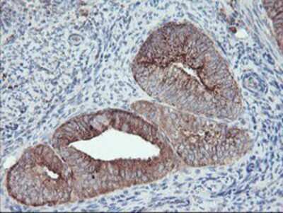 Immunohistochemistry-Paraffin: Carboxypeptidase A2/CPA2 Antibody (OTI1C7) [NBP2-01992]