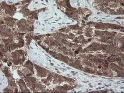 Immunohistochemistry: Carboxypeptidase A2/CPA2 Antibody (OTI3D8) [NBP2-46344]