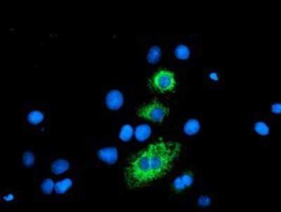 Immunocytochemistry/ Immunofluorescence: Carboxypeptidase A2/CPA2 Antibody (OTI1C7) - Azide and BSA Free [NBP2-70440]