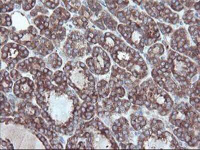 Immunohistochemistry: Carboxypeptidase A2/CPA2 Antibody (OTI1C7) - Azide and BSA Free [NBP2-70440]