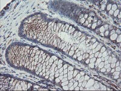 Immunohistochemistry: Carboxypeptidase A2/CPA2 Antibody (OTI1C7) - Azide and BSA Free [NBP2-70440]