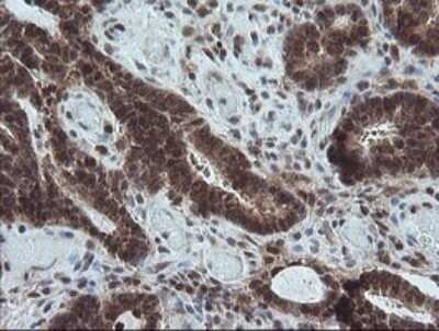 Immunohistochemistry: Carboxypeptidase A2/CPA2 Antibody (OTI3D8) - Azide and BSA Free [NBP2-70443]