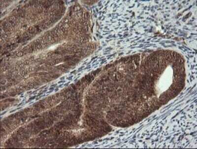 Immunohistochemistry: Carboxypeptidase A2/CPA2 Antibody (OTI3D8) - Azide and BSA Free [NBP2-70443]