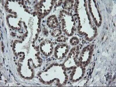 Immunohistochemistry: Carboxypeptidase A2/CPA2 Antibody (OTI3D8) - Azide and BSA Free [NBP2-70443]