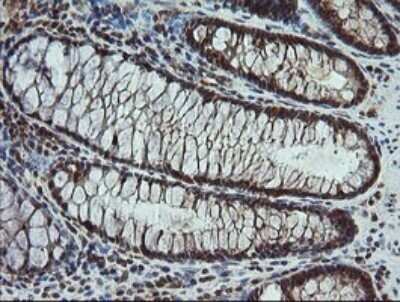 Immunohistochemistry: Carboxypeptidase A2/CPA2 Antibody (OTI3D8) - Azide and BSA Free [NBP2-70443]