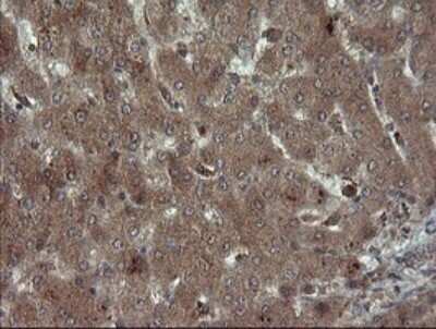 Immunohistochemistry: Carboxypeptidase A2/CPA2 Antibody (OTI3D8) - Azide and BSA Free [NBP2-70443]