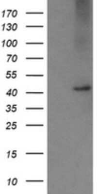 Western Blot: Carboxypeptidase A2/CPA2 Antibody (OTI3D8)Azide and BSA Free [NBP2-70443]