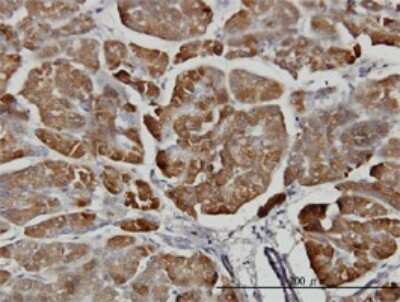 Immunohistochemistry-Paraffin: Carboxypeptidase B1/CPB1 Antibody (4D5) [H00001360-M01]