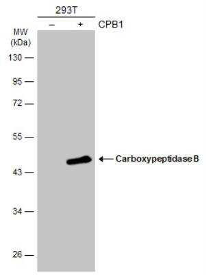 Western Blot: Carboxypeptidase B1/CPB1 Antibody [NBP2-15698]
