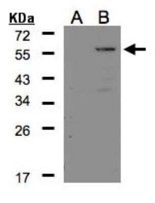 Western Blot: Carboxypeptidase E/CPE Antibody [NBP2-15699]