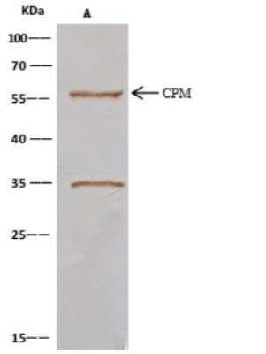 Immunoprecipitation: Carboxypeptidase M Antibody (105) [NBP2-89359]