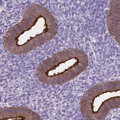 Immunohistochemistry-Paraffin: Carboxypeptidase M Antibody [NBP1-87403]