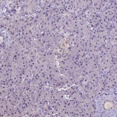 Immunohistochemistry-Paraffin: Carboxypeptidase M Antibody [NBP1-87403]