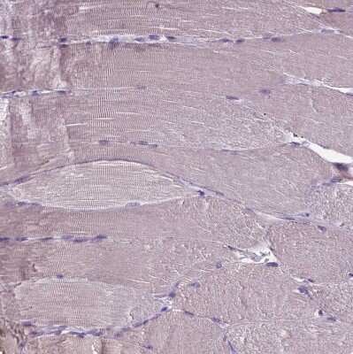 Immunohistochemistry-Paraffin: Carboxypeptidase M Antibody [NBP1-87403]