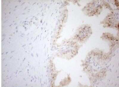 Immunohistochemistry: Carboxypeptidase M Antibody (OTI2D11) - Azide and BSA Free [NBP2-70446]