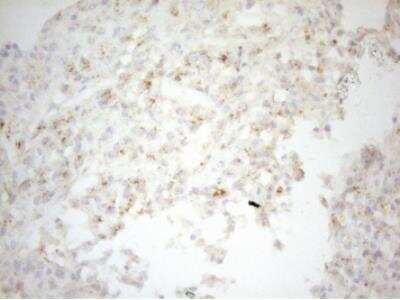Immunohistochemistry-Paraffin: Carboxypeptidase M Antibody (OTI2D11) [NBP2-46352]