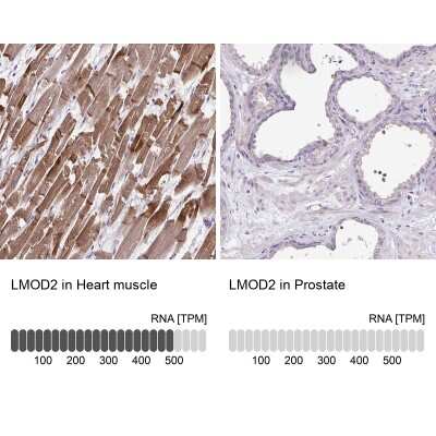 Immunohistochemistry-Paraffin: Cardiac Leiomodin Antibody [NBP2-30648]