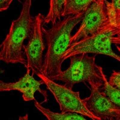 Immunocytochemistry/ Immunofluorescence: Carm1 Antibody (3H2) - BSA Free [NBP2-37645]