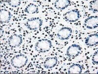 Immunohistochemistry: Carnosine Dipeptidase 1/CNDP1 Antibody (OTI2F8) - Azide and BSA Free [NBP2-72300]