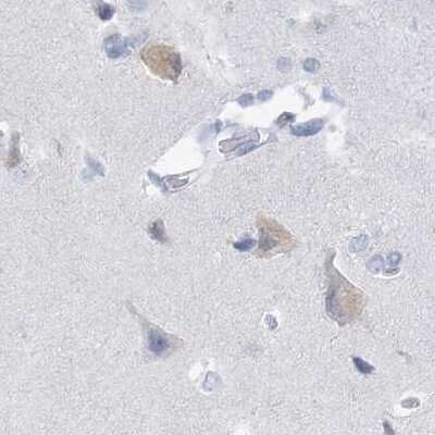 Immunohistochemistry-Paraffin: Casein Antibody [NBP1-91150]