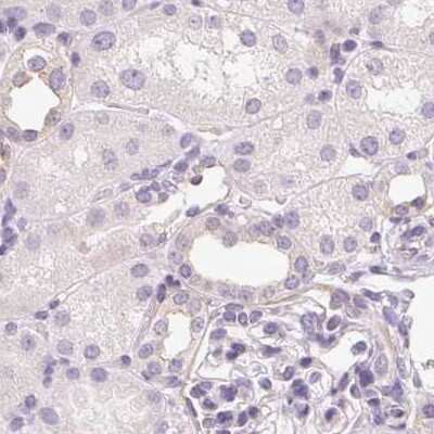 Immunohistochemistry-Paraffin: Casein Antibody [NBP2-55090]