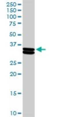 Western Blot: Casein Antibody [H00001446-D01P]