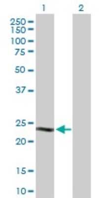 Western Blot: Casein Antibody [H00001446-D01P]