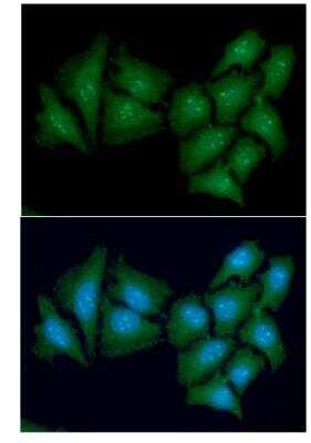 Immunocytochemistry/ Immunofluorescence: Casein Kinase 1 alpha Antibody (2E2) - BSA Free [NBP1-30165]