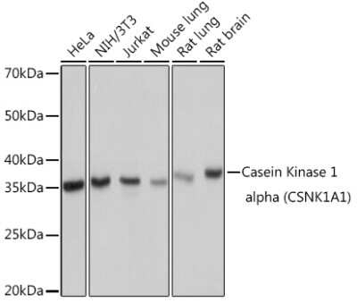Western Blot: Casein Kinase 1 alpha Antibody (9O4L9) [NBP3-16807]