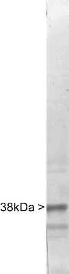 Western Blot: Casein Kinase 1 alpha Antibody [NBP2-50030]