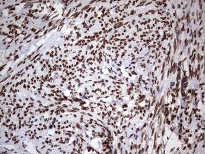 Immunohistochemistry: Casein Kinase 1 epsilon Antibody (OTI5D4) [NBP2-46377]