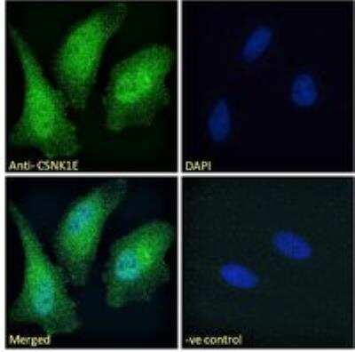 Immunocytochemistry/ Immunofluorescence: Casein Kinase 1 epsilon Antibody [NB100-93388]