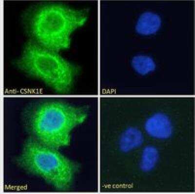 Immunocytochemistry/ Immunofluorescence: Casein Kinase 1 epsilon Antibody [NB100-93388]