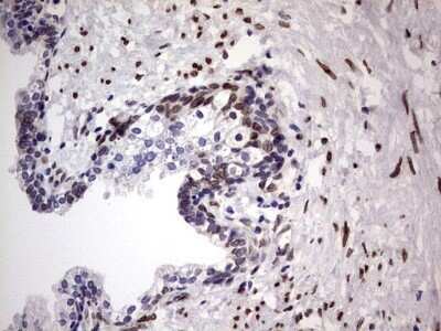 Immunohistochemistry: Casein Kinase 1 epsilon Antibody (OTI5D4) - Azide and BSA Free [NBP2-70464]
