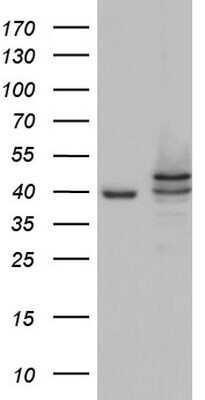 Western Blot: Casein Kinase 1 epsilon Antibody (OTI5D4)Azide and BSA Free [NBP2-70464]