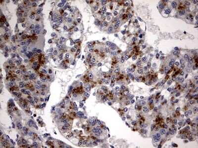 Immunohistochemistry: Casein Kinase 1 gamma 2 Antibody (OTI4H3) [NBP2-46385]