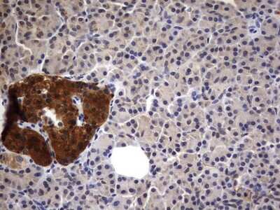 Immunohistochemistry: Casein Kinase 1 gamma 2 Antibody (OTI4H3) [NBP2-46385]