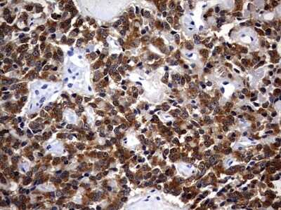 Immunohistochemistry: Casein Kinase 1 gamma 2 Antibody (OTI4H3) [NBP2-46385]
