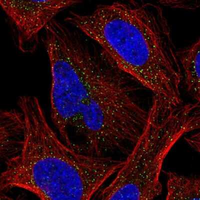 Immunocytochemistry/ Immunofluorescence: Casein Kinase 1 gamma 2 Antibody [NBP2-49232]